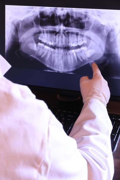 Best Emergency Tooth Extraction in Easley, SC